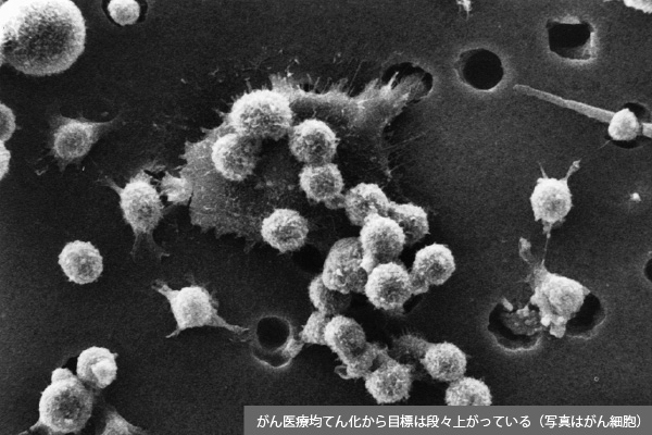 がん拠点病院から上がる「便利屋じゃない」の悲鳴