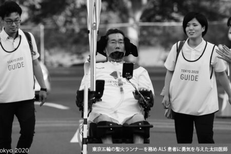 ALSの医師が見た「患者視点」が欠けた行政対応